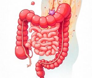 Diarrhea